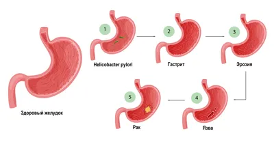 Невроз желудка: симптомы и лечение | Блог о здоровье