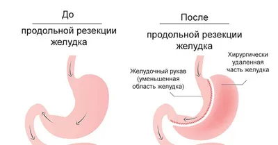 Желудок - 3D-сцены - Цифровое образование и обучение Мozaik