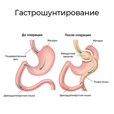 Чувствуете тяжесть в желудке? – Массируйте акупунктурные точки - jaseng.ru