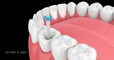 Как удаляют зубы? Методы удаления зубов