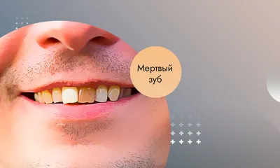Строение зуба: из чего состоит, функции, анатомия и расположение в челюсти