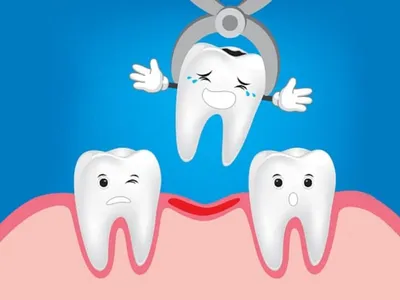Как выглядит зуб и как корень зуба Альтернативная медицинская клиника