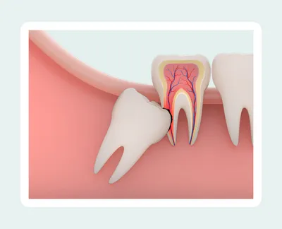 Определяем болезни по зубам, диагностика